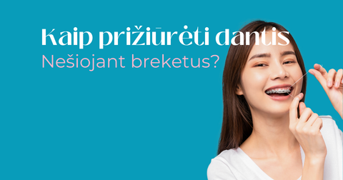 Dantų priežiūra breketų nešiojimo metu