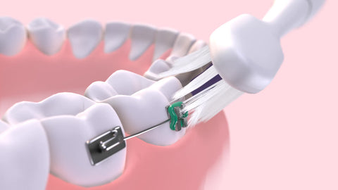 GUM® SONIC ORTHO elektriskā zobu birste
